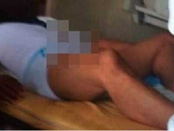 In ospedale con un’erezione di tre giorni: aveva assunto stimolanti sessuali per tori