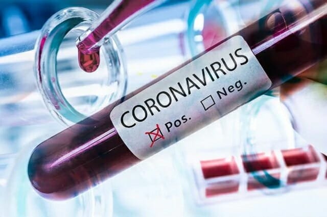 Coronavirus, 9 casi all’ospedale di Reggio Calabria: contagiati anche sanitari