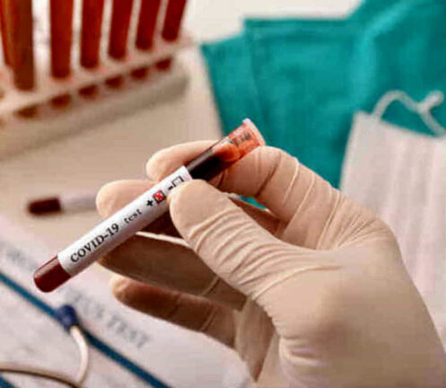 Coronavirus: avremo più reagenti? E i test sierologici?