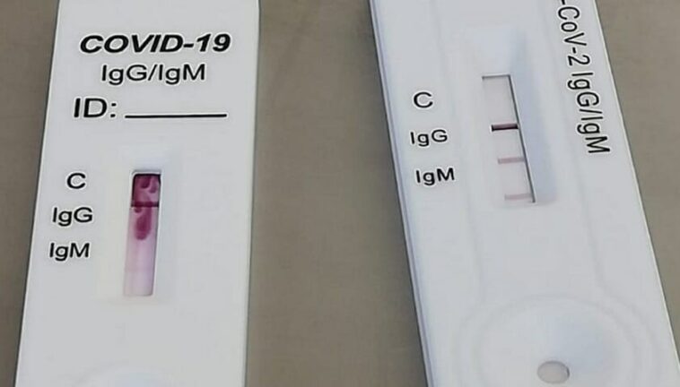 Covid, al via indagine di sieroprevalenza in Italia