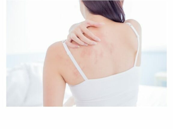 CORONAVIRUS: il COVID-19 si può vedere anche sulla PELLE