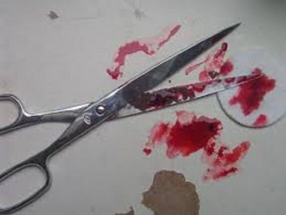 Napoli: lite tra fratelli finisce nel sangue, 21enne ferito a forbiciate dalla sorella 15enne.