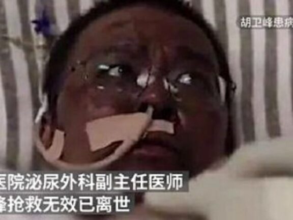 Morto il medico cinese che si era risvegliato con la pelle nera