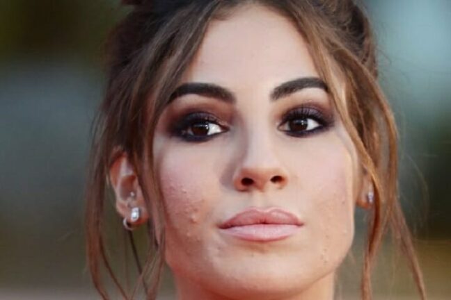 Giulia De Lellis, incidente per lei: fan preoccupatissimi