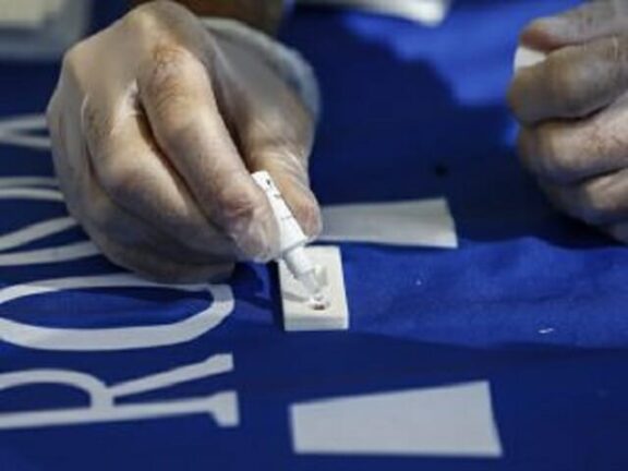 Pretende il test sierologico Covid e aggredisce dipendente Asl