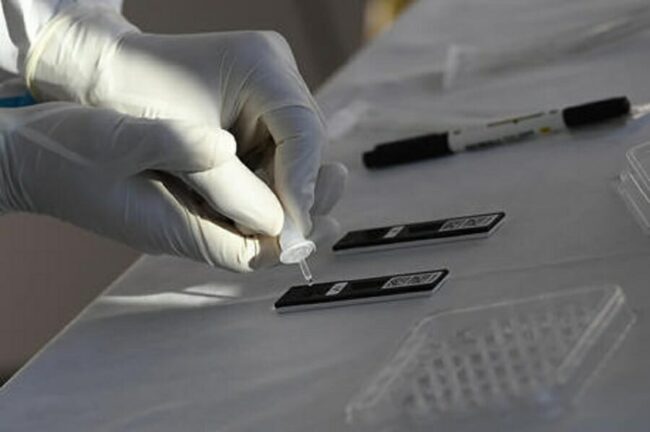 Covid: 1.737 i casi positivi e 48 i decessi oggi in Puglia