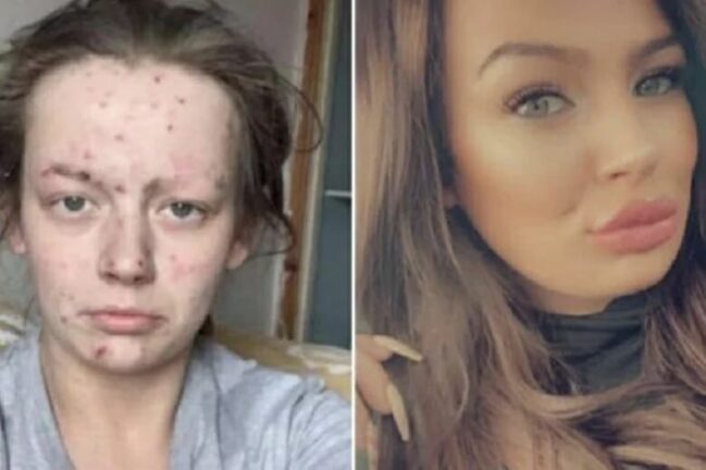 “Così mi aveva ridotto la droga”, Demi condivide le sue foto: “Uscirne è possibile”