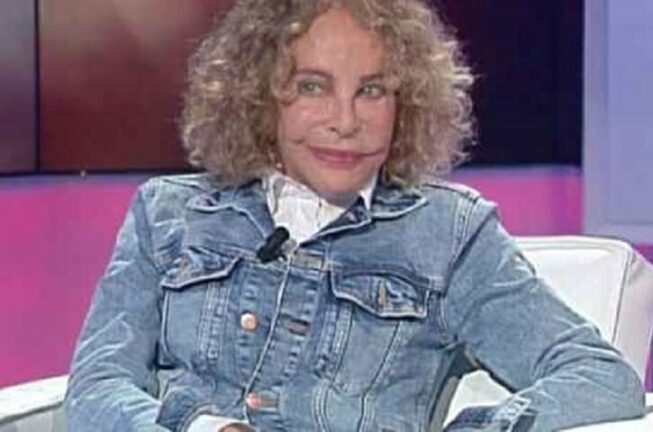 Sydne Rome: “Mi è esploso l’airbag in faccia, mi hanno ricucito la pelle..”