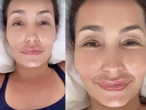 Caterina Balivo: “non mi piacevo e ho deciso di ritoccarmi, ora sono un mostro…”