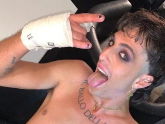 Damiano dei Maneskin: quello che accade lascia senza fiato