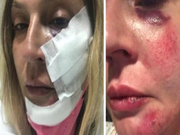 Docente in vacanza in Calabria aggredita da 4 persone