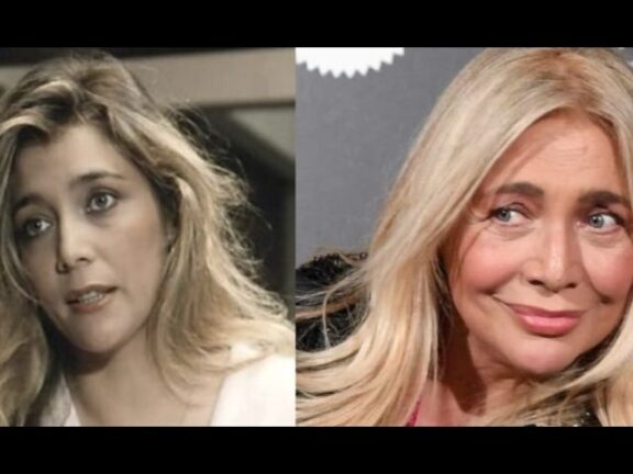 Mara Venier la foto mostra il drammatico cambiamento