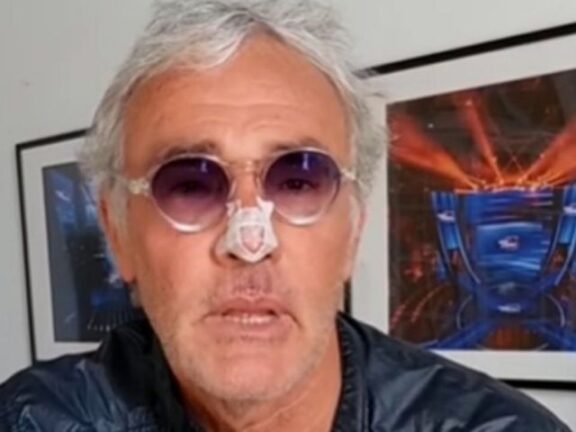 Massimo Giletti shock corsa in ospedale e naso fratturato