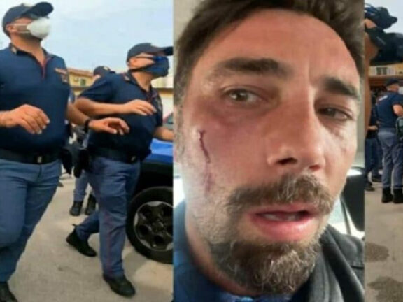 Striscia la Notizia: aggressione Brumotti, “strana” richiesta dei poliziotti