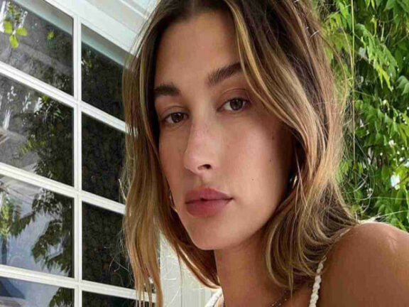 Hailey Bieber, modella, ricoverata d’urgenza in ospedale