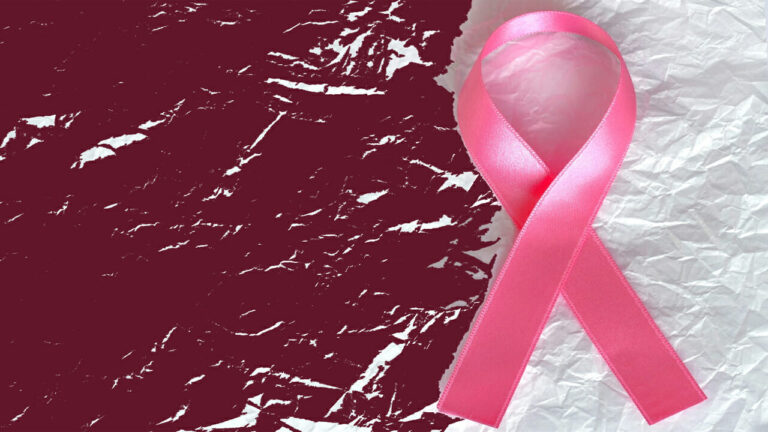 Cancro al seno: test del sangue dice subito se la cura va bene