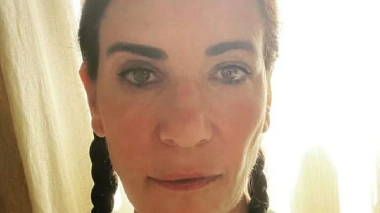 Paola Turci in ospedale: trauma cranico