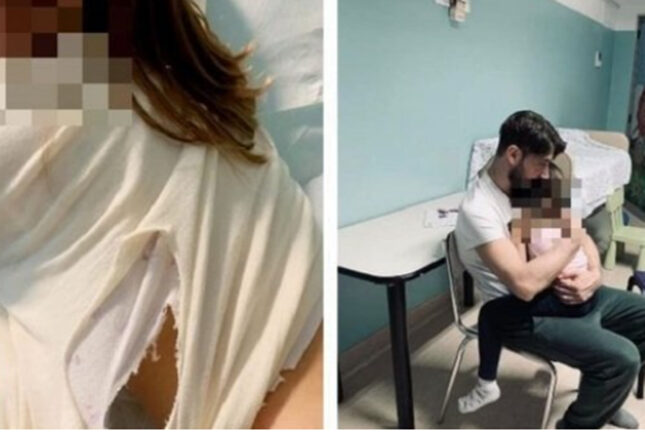 Vasto: bimba di 4 anni azzannata da un cane lupo