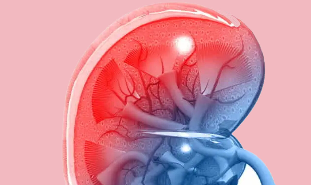 Trapianto di rene: in arrivo quello artificiale antirigetto