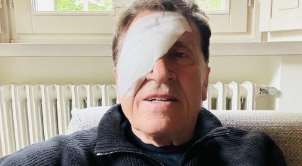 Gianni Morandi con l'occhio bendato. Cosa è successo?