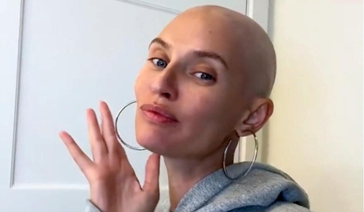 Bianca Balti si mostra senza capelli dopo la chemio