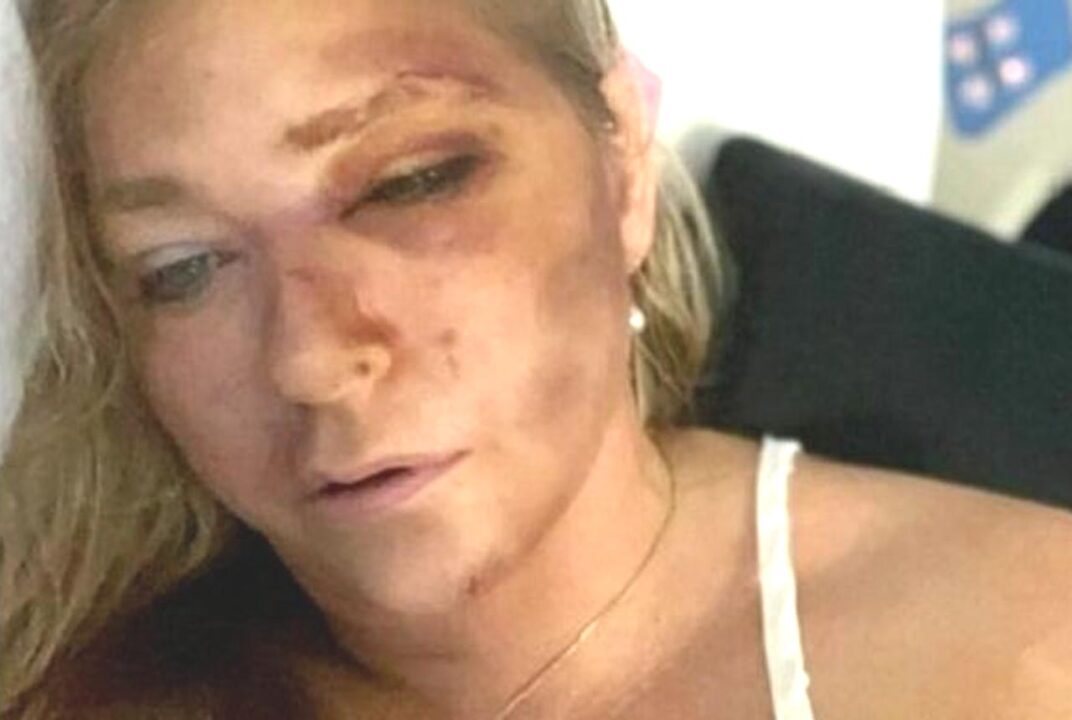 Virginia Giuffre si è tolta la vita