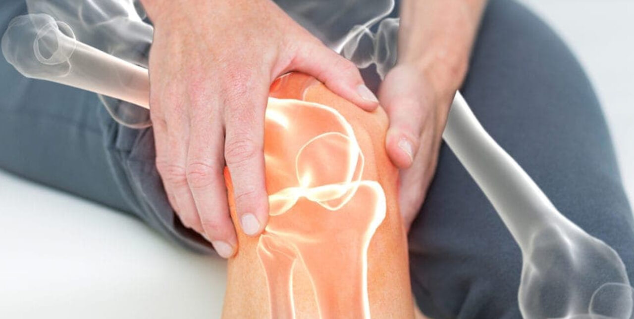 Artrite: la cartilagine artificiale come soluzione?