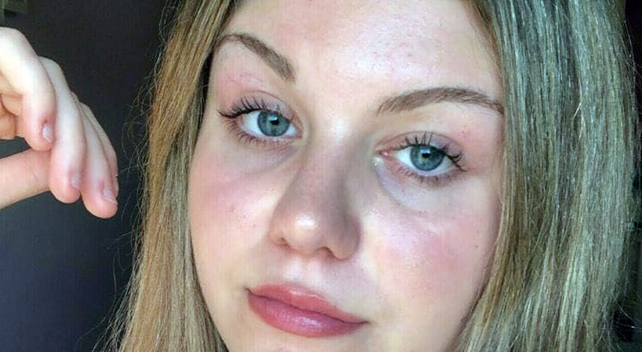 Eleonora Chieregato muore a 17 anni per una malattia autoimmune