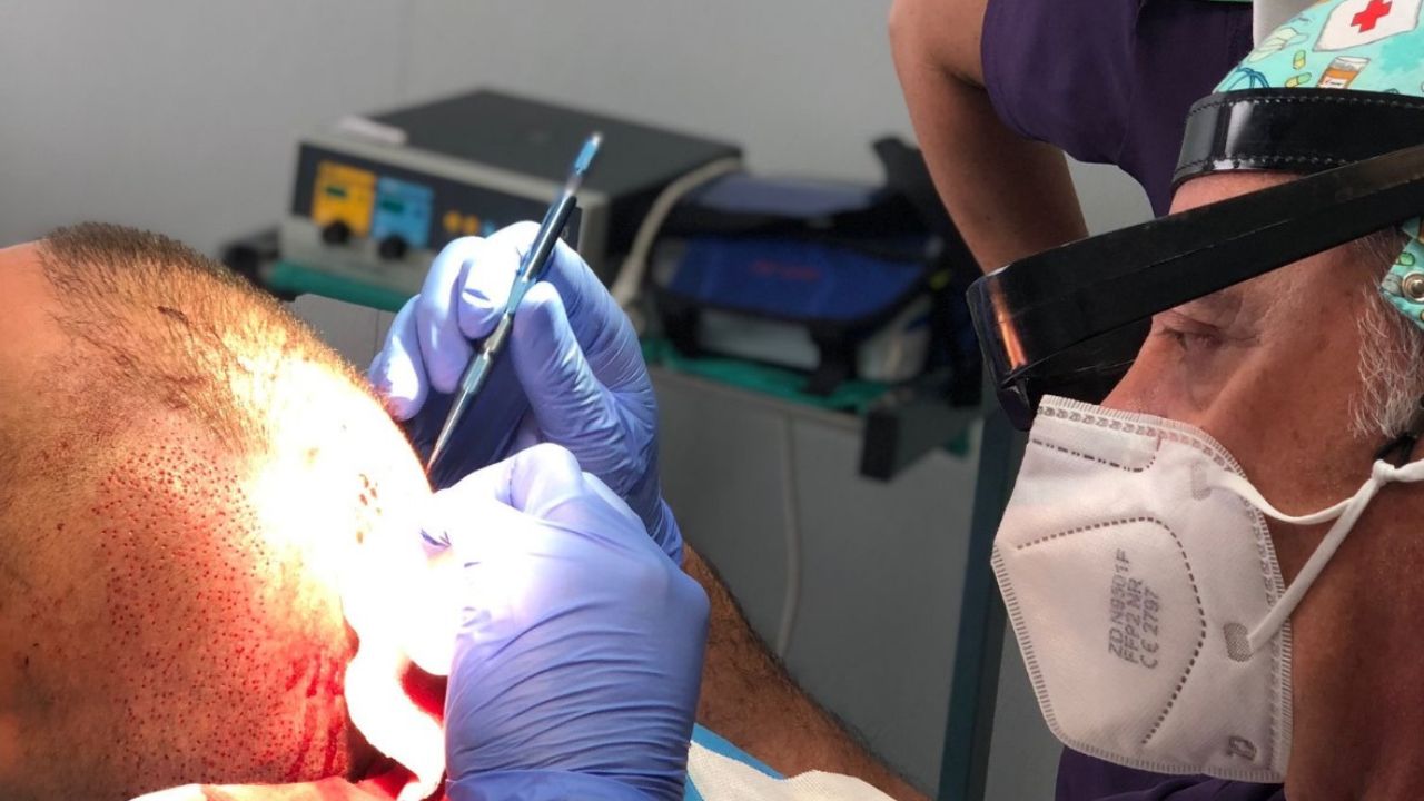 TRAPIANTO DI CAPELLI FUE: LA TECNICA CHE RESTITUISCE NATURALEZZA E FIDUCIA IN SÉ, SECONDO L’ESPERTO STEFANO PASTORINI DI LANDEN TRICOLOGIA