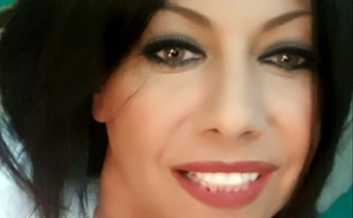 Milena Mancini perde la vita dopo liposuzione in Turchia