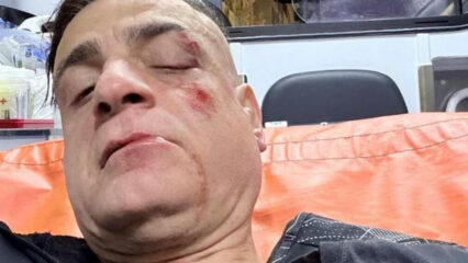 Lo youtuber Cicalone aggredito nella metro di Roma