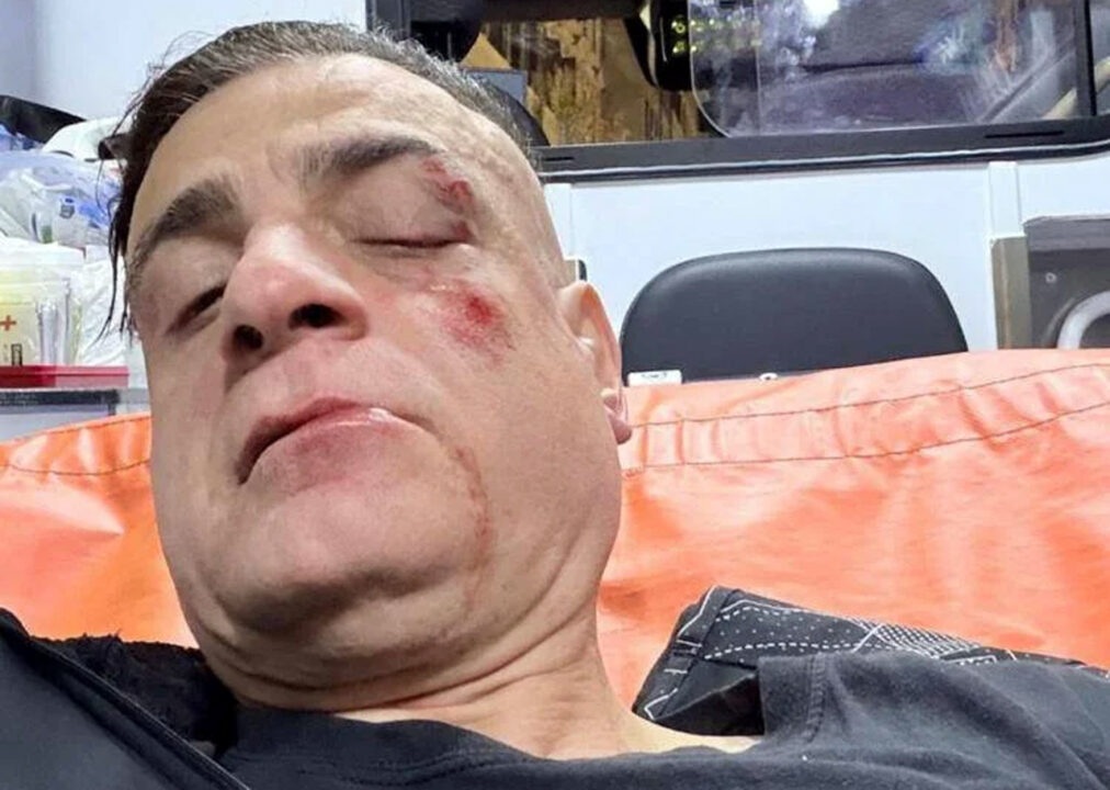 Lo youtuber Cicalone aggredito nella metro di Roma