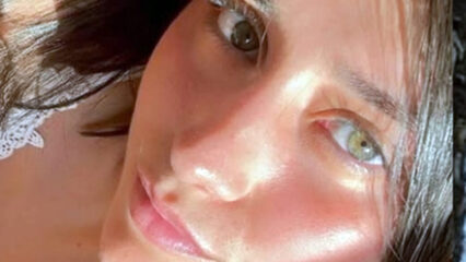 Matilde Baldi muore a 20 anni dopo cinque giorni di agonia