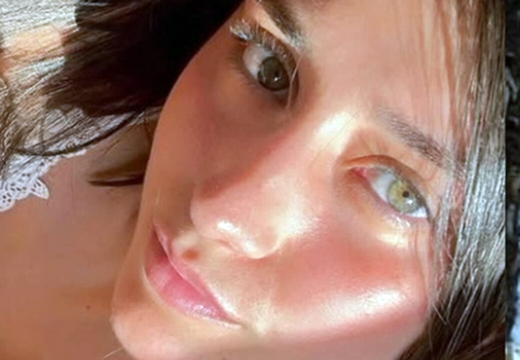 Matilde Baldi muore a 20 anni dopo cinque giorni di agonia