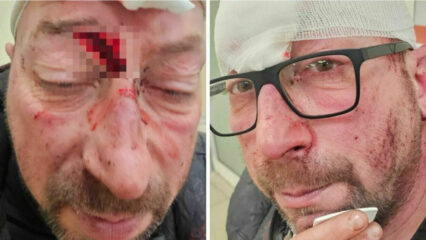 Ivan Panizzolo aggredito con un piede di porco a Vigonovo