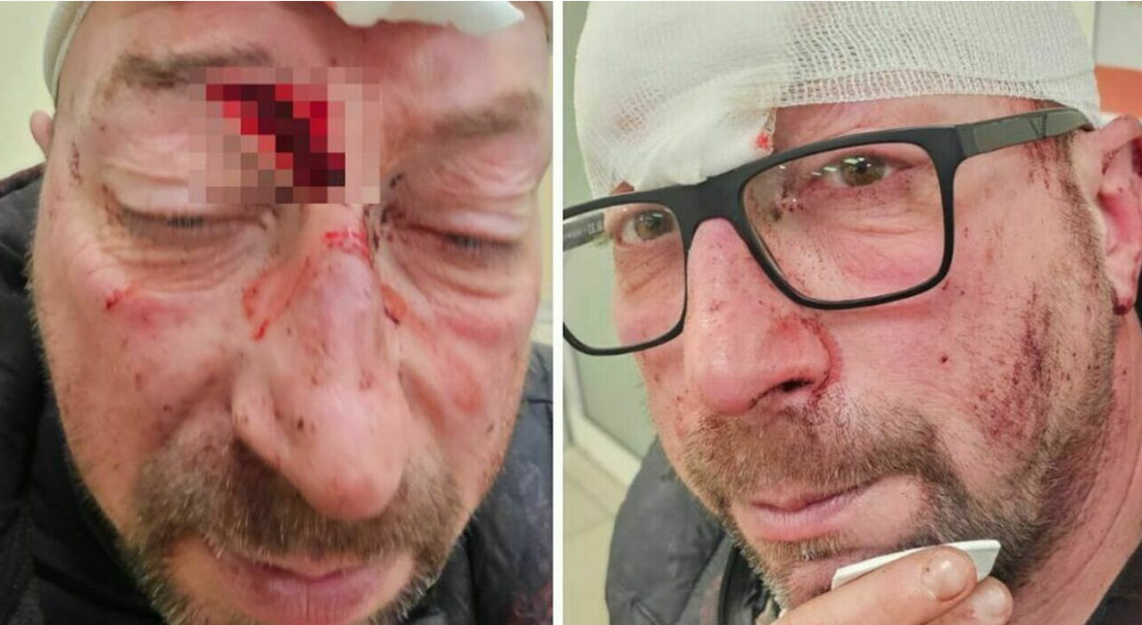 Ivan Panizzolo aggredito con un piede di porco a Vigonovo