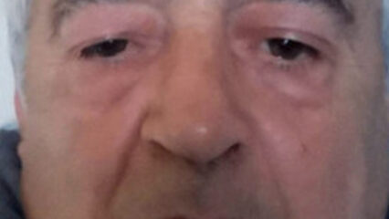 Sannio: ergastolo per Benito Miarelli. Uccise e decapitò il fratello a Pannarano