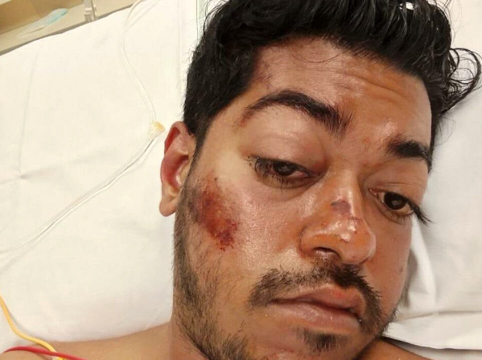 Marghera: aiuto cuoco di 30 anni muore dopo un pestaggio