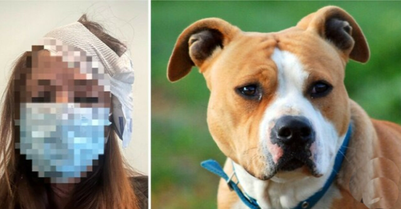 Padova: azzannata alla testa da un cane Amstaff